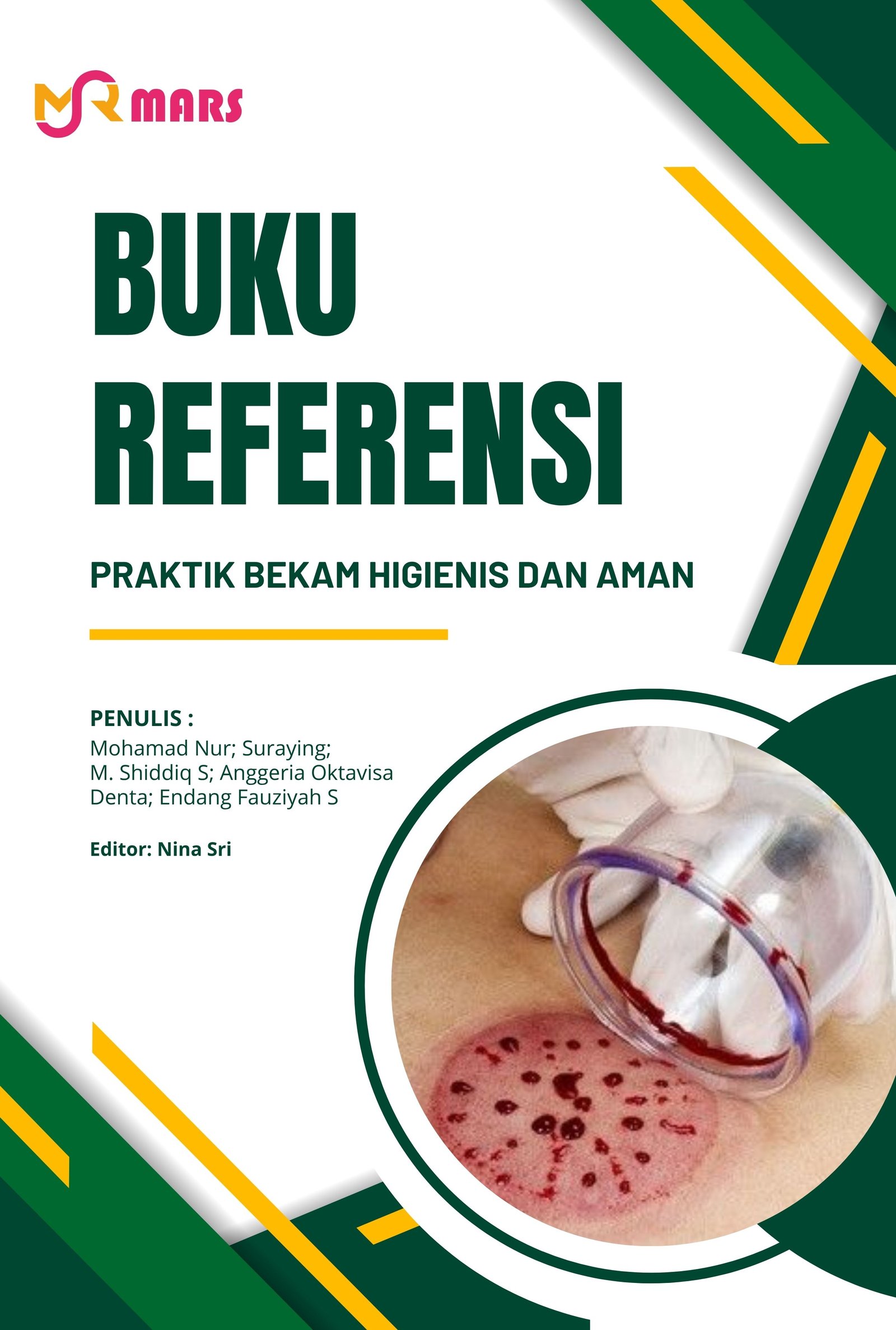 Praktik Bekam Higienis dan Aman